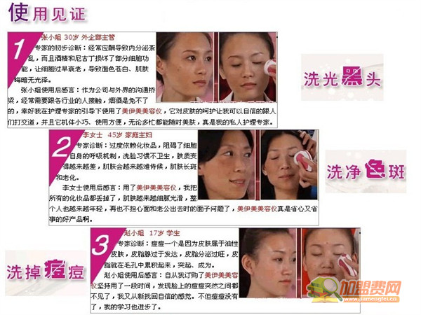 美伊美洗脸仪加盟