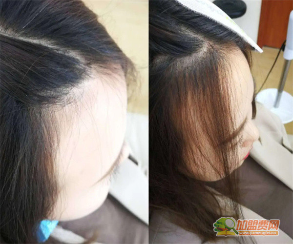 美丝珈物理增发加盟