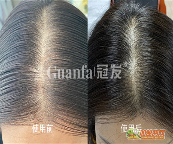 冠发生发加盟